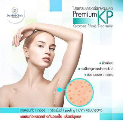 โปรแกรมเลเซอร์รักษาขนคุด Keratosis Pilaris (KP) Premium KP Laser Treatment Program