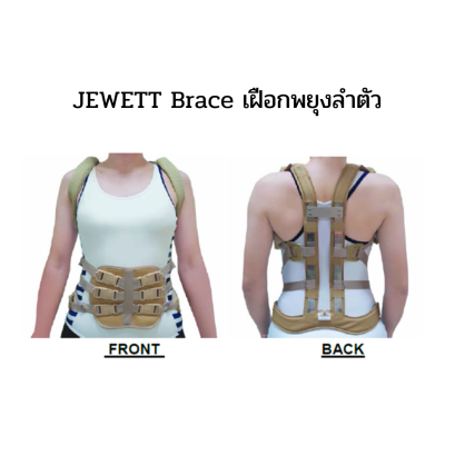 Jewett Brace / เฝือกพยุงลำตัว