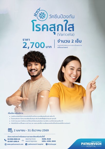 วัคซีนป้องกันโรคสุกใส (Varicella)