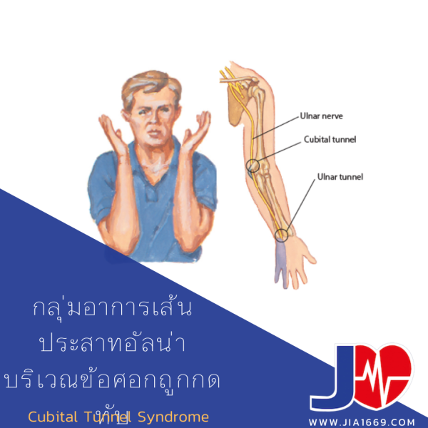 jia1669