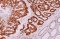 Immunohistochemistry Analyzer