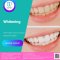 Teeth Whitening