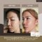 รีวิวผู้ใช้จริง Sophist Age-Delay Collection