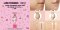 MILLE SUPER WHITENING GOLD ROSE BB CREAM SPF 30 PA++ (LINE FRIENDS) #1 Silky Ivory