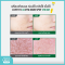 Curesys Acvita เคียวร์ซิส แอควิต้า ดาร์ค สปอต ครีม กู้รอยสิว ผิวใส ชุ่มชื้น นุ่ม เรียบเนียน