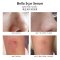 Bella Scar Serum (ซีรั่มลดรอยแผลเป็น) ขนาด 12 กรัม จากสารสกัดสมุนไพรไทย