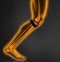 JASON เจสัน ผ้าซัพพอร์ต รัดเอ็น ข้อ หัวเข่า ยืนหยุ่นดี รุ่น X-Neoprene Knee Strap JS0494 Free Size ปรับขนาดได้