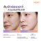 MERCI PHYTO-RETINOL GENTLE RENEWAL SERUM 30 ml.