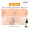 Merci Vitamin C Extra Bright Serum 10 ml.