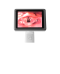 Video Laryngoscope