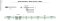 SH-M Flame • Master-Cut Burs • Metric
