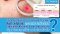รักษาหลุมสิวด้วยเลเซอร์กรอผิวชนิดลอกทั้งช้ันผิว Full field vs ลอกแบบแบ่งส่วน Fractional Ablative Laser Resurfacing มีจุดเด่นและการใช้แตกต่างกันอย่างไร ?