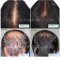 HairMax LaserBand 41 – ComfortFlex แบบที่ผมคาดผม ***พิเศษเฉพาะที่ DeMed Clinic เท่านั้น*** / ิแถมพิเศษโปรแกรม Triple H Treatment ดูแลผมร่วงผมบาง1 ครั้ง