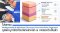 โปรแกรม Multimodality & Multilayer Discovery Pico VarioPulse Treatment