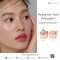Hyaluronic Acid หรือ ไฮยาลูรอน สำคัญอย่างไรต่อผิว ?