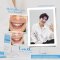 (ส่งฟรี)ชุดคู่คุ้มสุด ฟันขาวยาวนาน LINEE Teeth Whitening kit+refill  เจลฟอกฟันขาว ฟันขาวจั๊ว ฟอกฟันขาว ฟันขาว